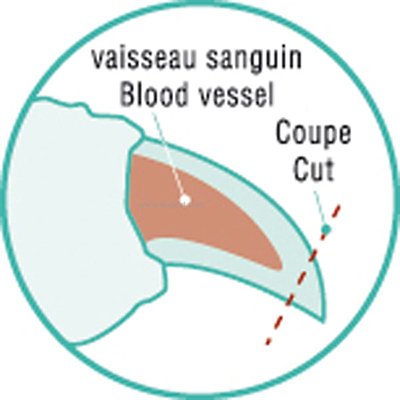 schema_coupeongles_L.jpg