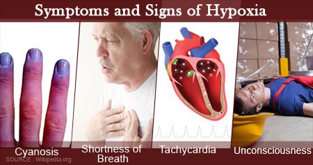 Hypoxia (medicine) - Wikipedia