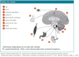 Reflejo-vomito1.jpg