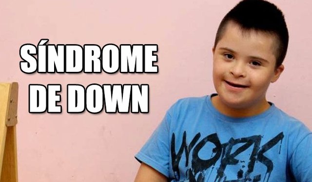 Portada Sindrome de Down.jpg