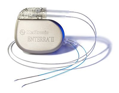 Gastric Electrical Stimulators.jpg