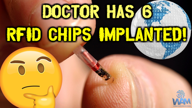 doctor has 6 rfid chips implanted thumbnail.png