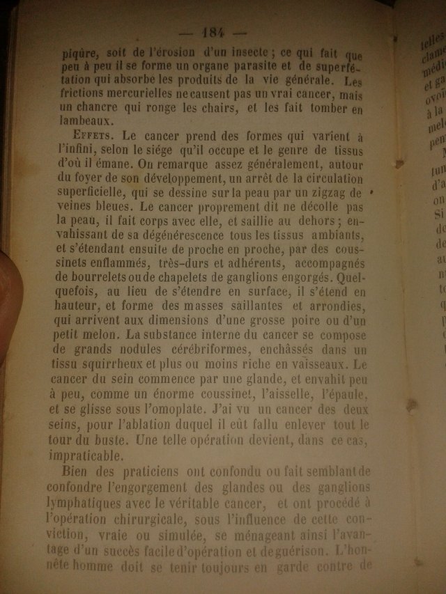 Manuel anuaire de la santé 1853 B Cancer2.jpg