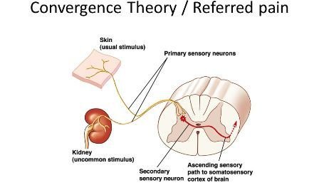 +Referred+pain.jpg