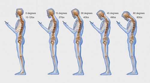 neck-illustration.jpg