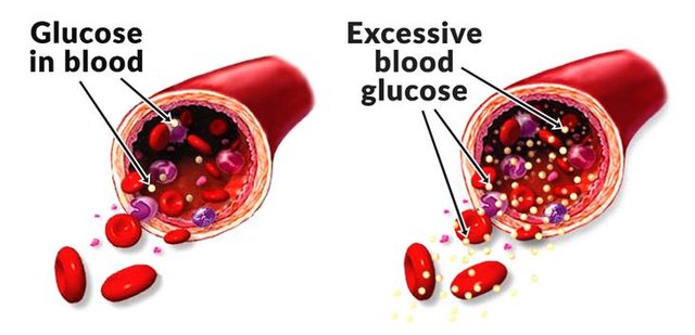 blood-sugar-levels-and-paleo_diagram_of_excessive_blood_glucose.jpg