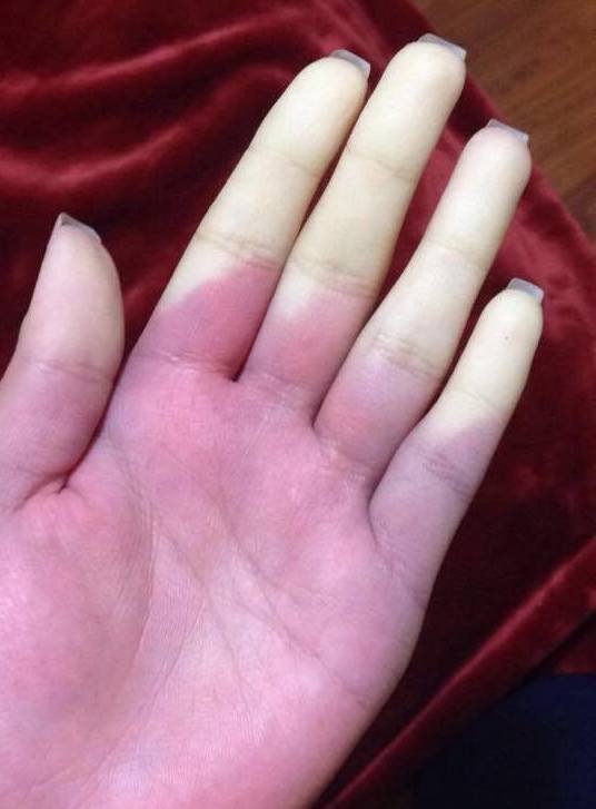 Raynauld.jpg