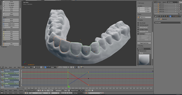 3d-scan-braces.png