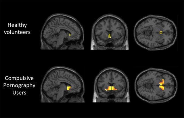 porn-addiction-brain-scan.jpg