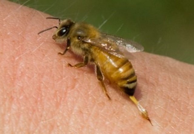 sengat-lebah (2).jpg