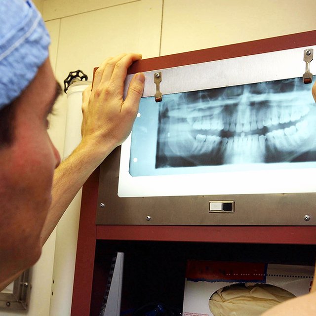 types of dental x-rays.jpg