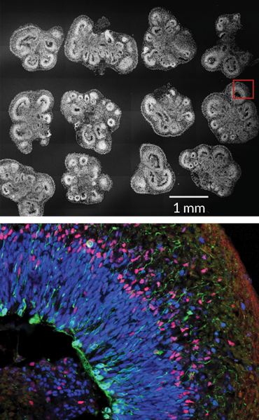 030318_organoids_inline_1_370 (1).png