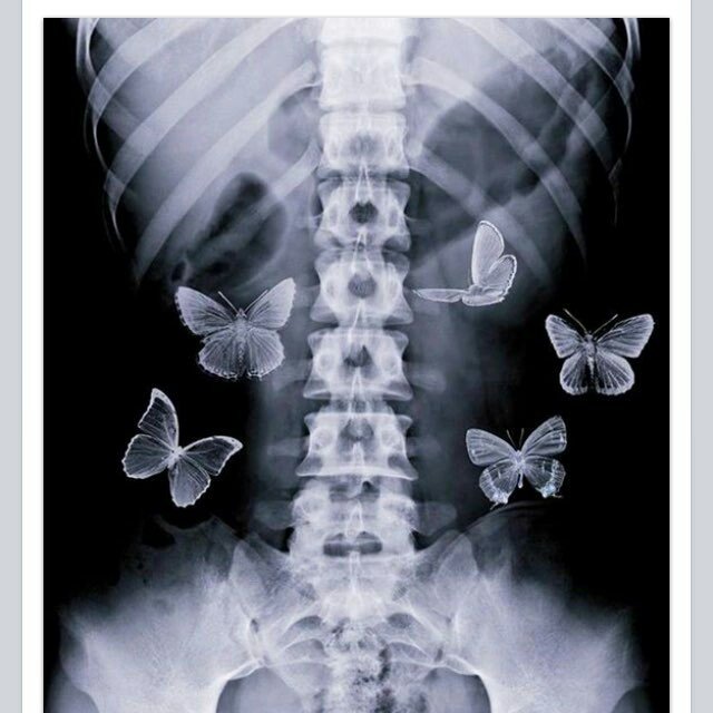 butterflies in stoamch.jpg