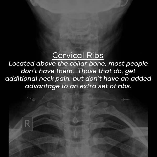 turns_out_we_have_many_organs_that_we_could_easily_live_without_640_20.jpg
