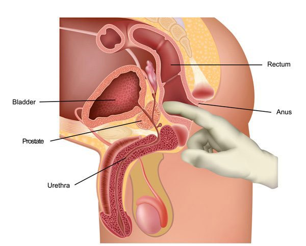 ProstateExam_WEB.jpg