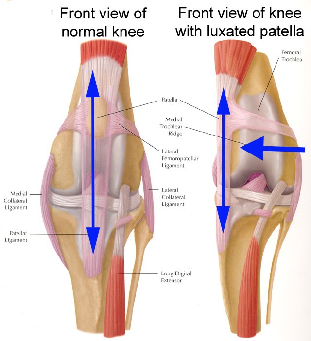 knee-dislocation.jpg