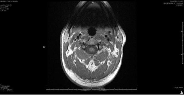 cervical 6.jpg