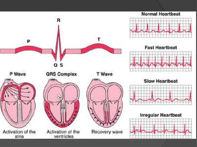 arritmias-cardiacas-3-728.jpg