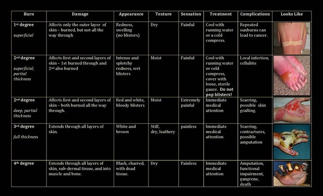 Burn-chart.jpg