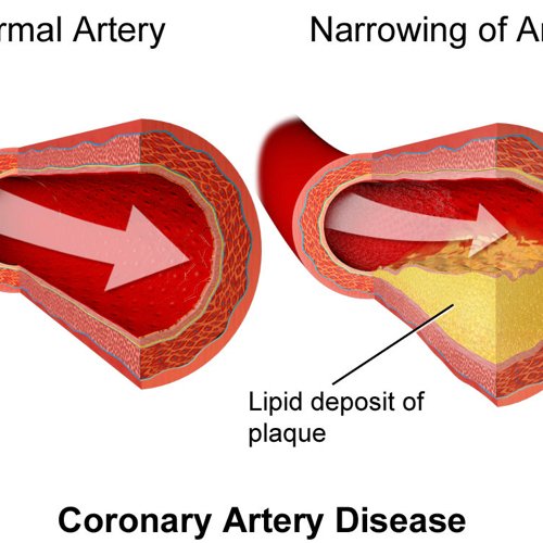 Cholesterol.jpeg