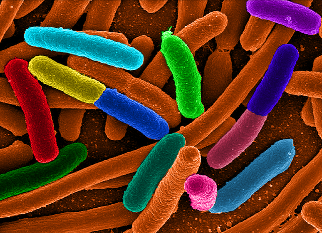 Diverse_e_Coli.png