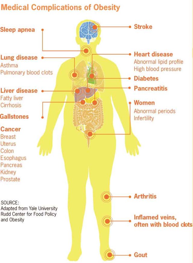 751px-Medical_complications_of_obesity.jpg