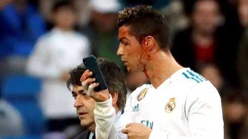 1307-cristiano-ronaldo-bleeding-from-his-face-uses-a-mobile-phone-to-watch-himself-in-the-mirror.jpg