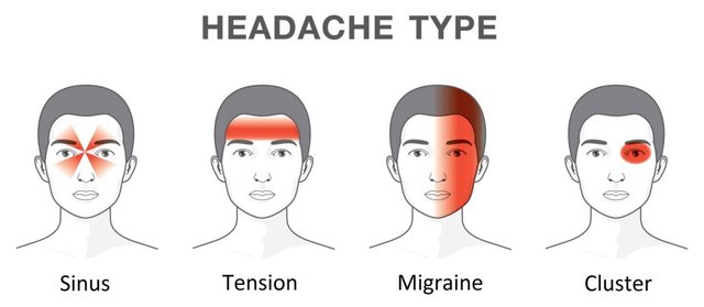 types-of-headaches-1030x449.jpg