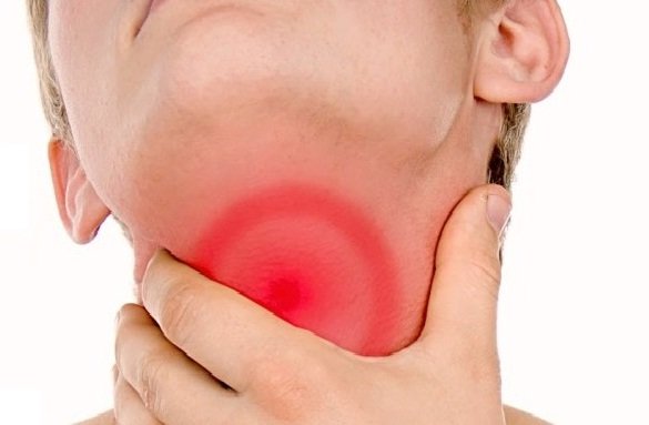 Babool-for-Tonsillitis-in-Hindi.jpg