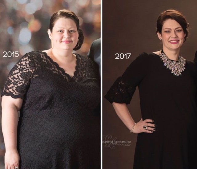 This Woman Loss 150 Pound 68kg Steemit