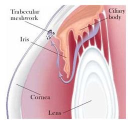 glaucoma-meshwork.jpg