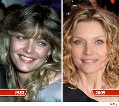 ab317a22e4bd2b6bc6c543ba54b41a06--celebrity-surgery-nose-jobs.jpg