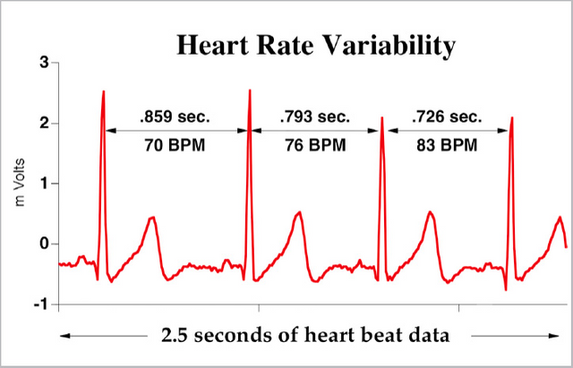HRV_chart.png