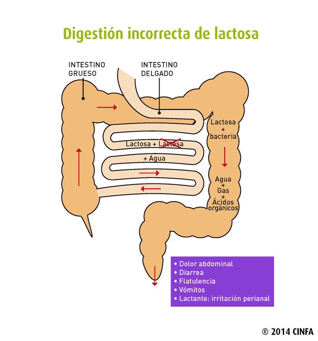 GRÁFICO-INTOLERANCIA-LACTOSA.jpg