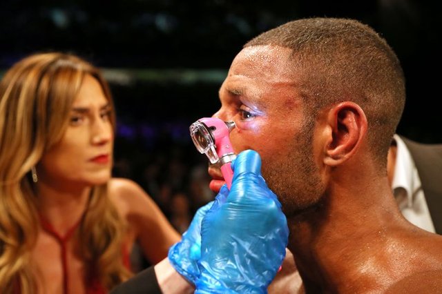 Kell-Brook-broken-left-eye-socket.jpg