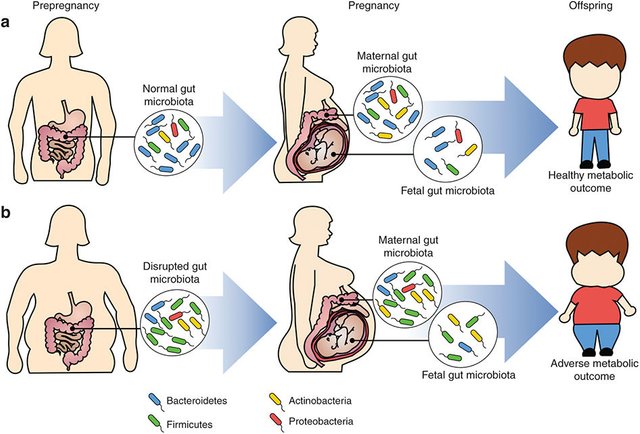 Microbiome-Obesity 1.jpeg