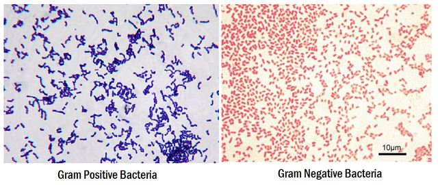 gram-positive-vs-gram-negative.png