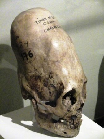 elongated skull 1.JPG