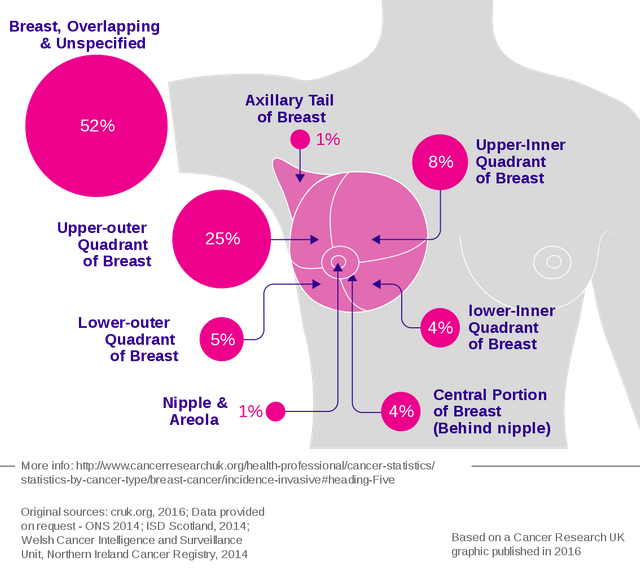 Breast_cancer_incidence_by_anatomical_site_(females).svg.png