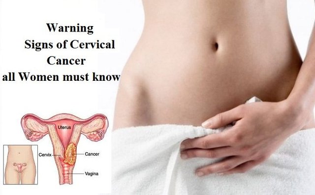 Warning-Signs-of-Cervical-Cancer-all-Women-must-know-720x445.jpg