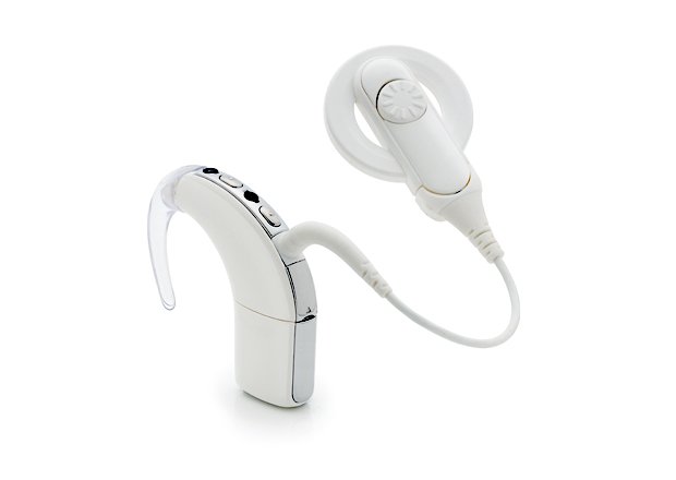 Cochlear-Implant.jpg