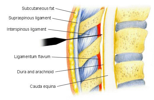 spinal.jpg