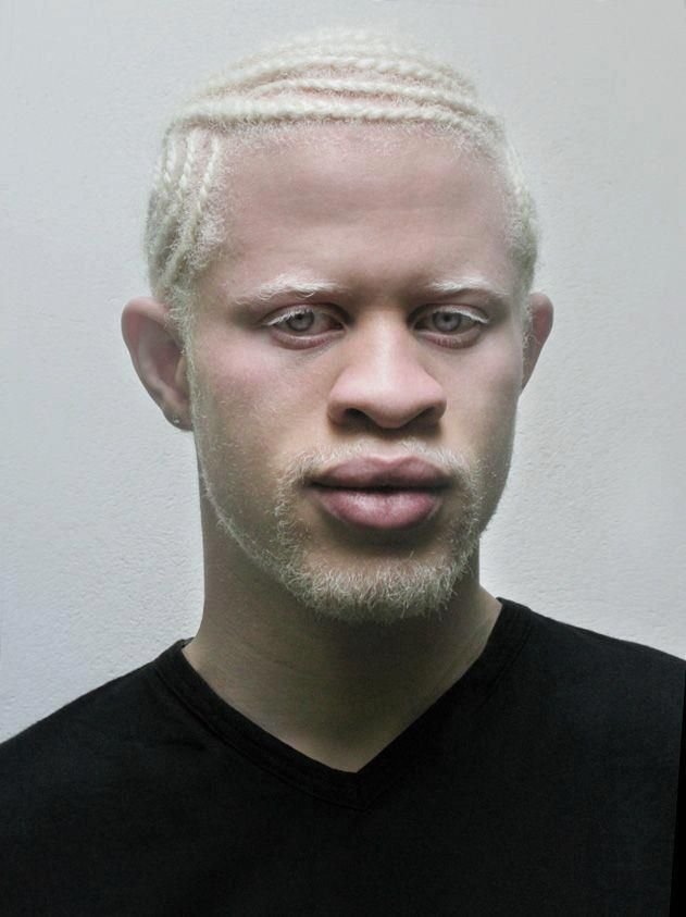 ac5c49c979919f9fccc51f183f61b5bd--albino-african-black-man.jpg