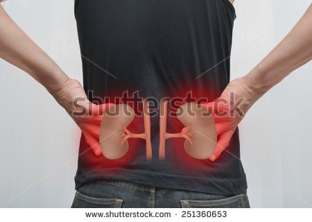 stock-photo-human-kidney-failure-251360653.jpg