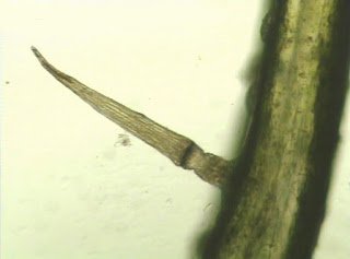 Dionaea-muscipula-Ausloeseborste-Mikroskopaufnahme.jpg