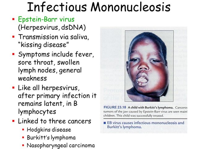 Childhood Diseases On A Mission To Educate Infectious Mononucleosis Steemit