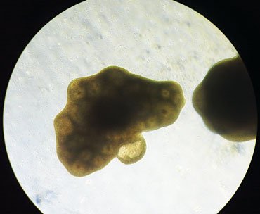 030318_organoids_inline_4_370.jpg