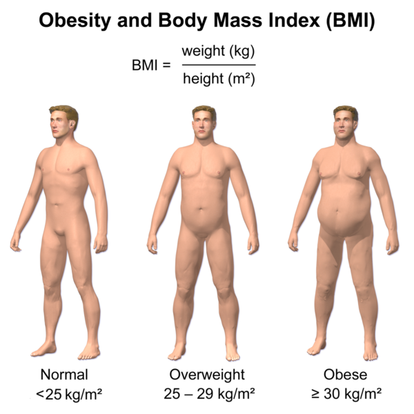 600px-Obesity_%26_BMI.png