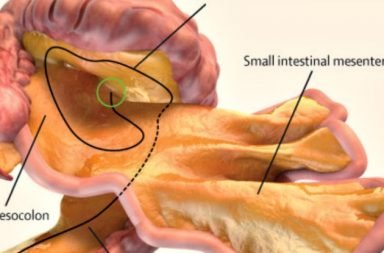 Mesentery-web_1024-384x253.jpg