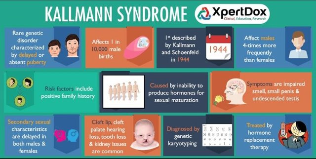 kallmann syndrome.jpg